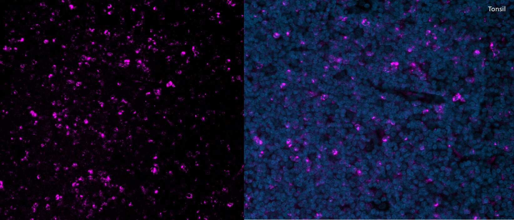 CTLA-4 Antibody (rCTLA4/7219) [Alexa Fluor® 647]