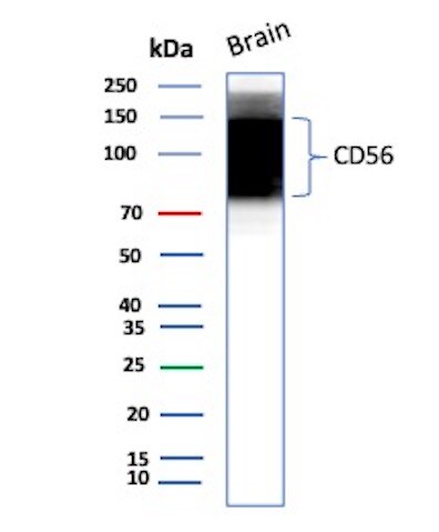 NCAM-1/CD56 Antibody (NCAM1/8392R) - Azide and BSA Free Western Blot: NCAM-1/CD56 Antibody (NCAM1/8392R) - Azide and BSA Free [NBP3-20816] -