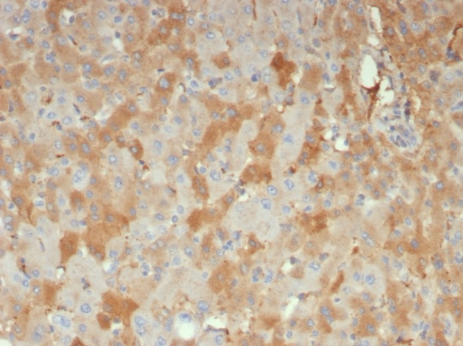 alpha 2-Macroglobulin Antibody (A2M/6556) - Azide and BSA Free