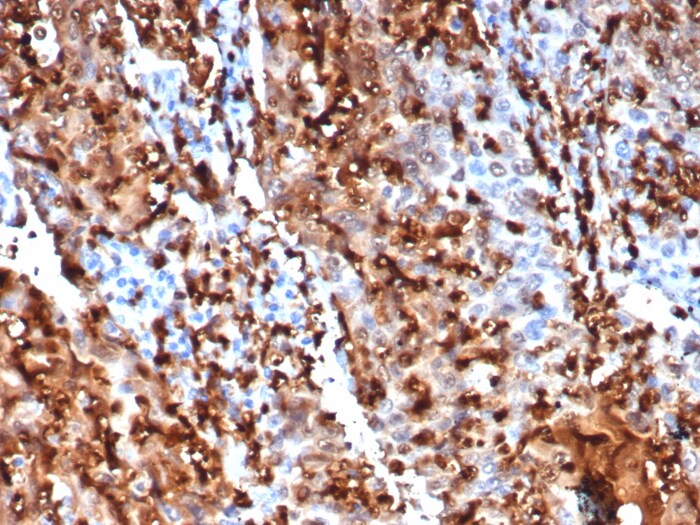 S100P Antibody (S100P/7373) - Azide and BSA Free S100P Antibody (S100P/7373) - Azide and BSA Free