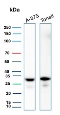 HLA-DR Antibody (HLA-DRA/6840R) - Azide and BSA Free Western Blot: HLA-DR Antibody (HLA-DRA/6840R) - Azide and BSA Free [NBP3-20837] -
