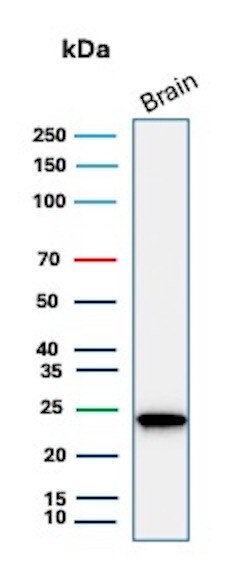 UCH-L1/PGP9.5 Antibody (UCHL1/7076R) - Azide and BSA Free Western Blot: UCH-L1/PGP9.5 Antibody (UCHL1/7076R) - Azide and BSA Free [NBP3-20842] -
