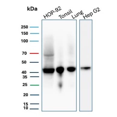 HLA ABC Antibody (MHC-I/8147R) - Azide and BSA Free Western Blot: HLA ABC Antibody (MHC-I/8147R) - Azide and BSA Free [NBP3-20852] -