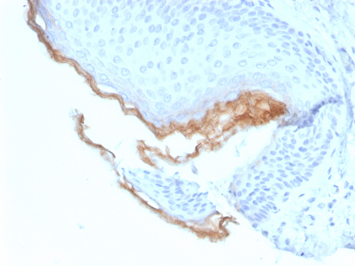 Kallikrein 5 Antibody (KLK5/3844) - Azide and BSA Free