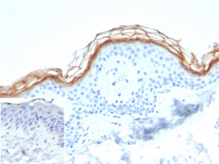Kallikrein 7 Antibody (KLK7/4693) - Azide and BSA Free