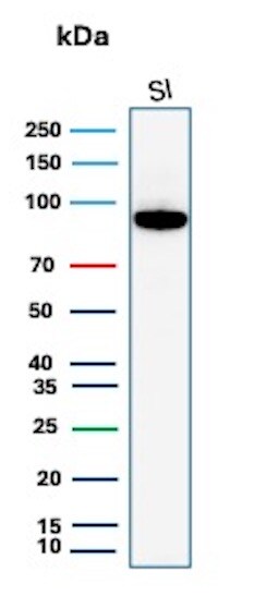 Cadherin-17 Antibody (rCDH17/8512) - BSA Free Western Blot: Cadherin-17 Antibody (rCDH17/8512) - BSA Free [NBP3-20888] -