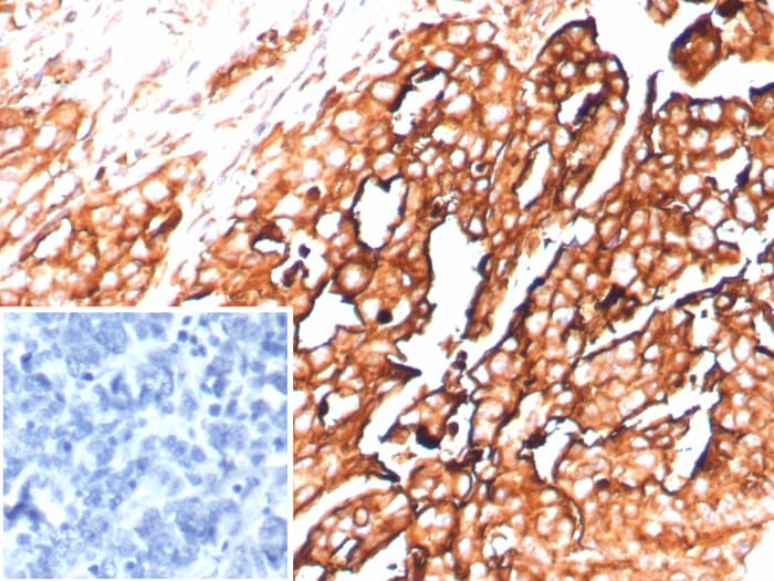 Mesothelin Antibody (rMSLN/8764) - Azide and BSA Free Mesothelin Antibody (rMSLN/8764) - Azide and BSA Free