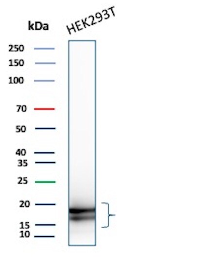 p16INK4a/CDKN2A Antibody (rCDKN2A/8004) - Azide and BSA Free Western Blot: p16INK4a/CDKN2A Antibody (rCDKN2A/8004) - Azide and BSA Free [NBP3-20898] -