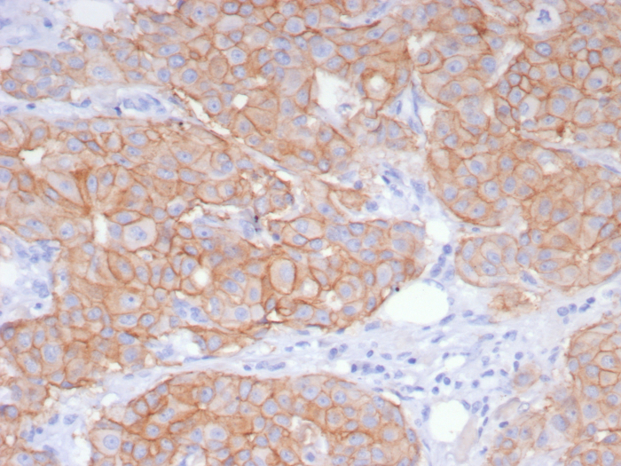 ErbB2/Her2 Antibody (ERBB2/8142R) - Azide and BSA Free