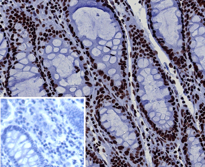 Brg1 Antibody (BRG1/7633R) - Azide and BSA Free