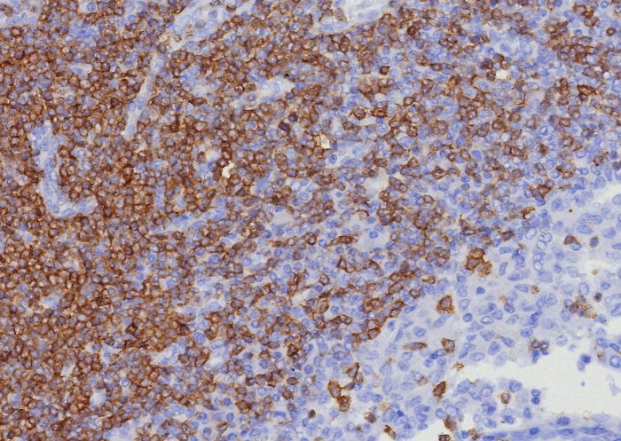 CD7 Antibody (CD7/8357R) - Azide and BSA Free