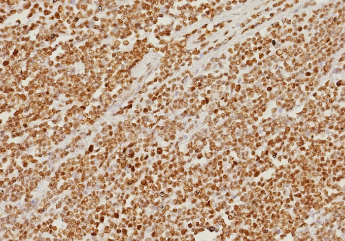 PMS2 Antibody (PMS2/8374R) - Azide and BSA Free