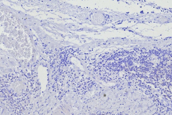 BOB1 Antibody (BOB1/7469) - Azide and BSA Free
