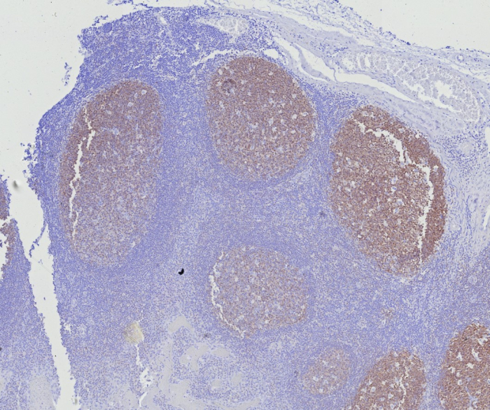 BOB1 Antibody (BOB1/7469) - Azide and BSA Free