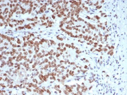 EZH2/KMT6 Antibody (EZH2/6988) - Azide and BSA Free