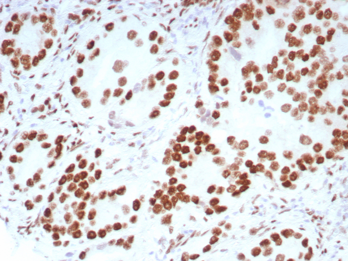 Androgen R/NR3C4 Antibody (DHTR/8698R) - Azide and BSA Free