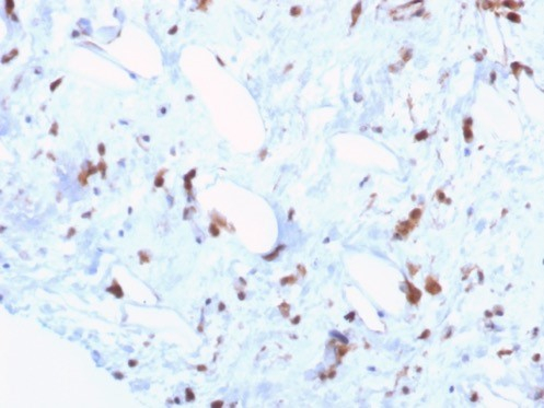 STAT6 Antibody (STAT6/7774R) - Azide and BSA Free