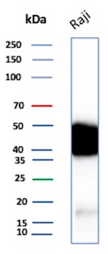 CD48/SLAMF2 Antibody (CD48/8360R) - Azide and BSA Free Western Blot: CD48/SLAMF2 Antibody (CD48/8360R) - Azide and BSA Free [NBP3-21026] -