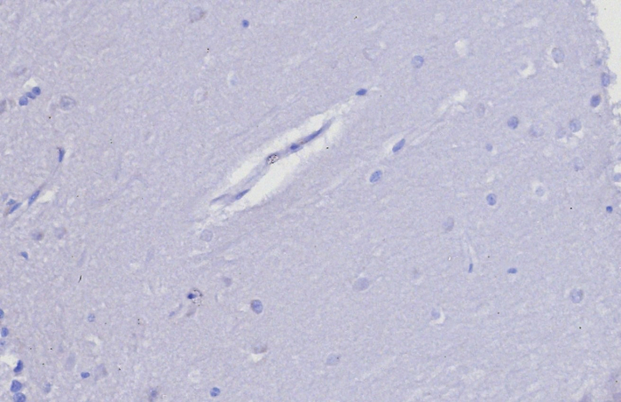 TIMP-2 Antibody (TIMP2/8193R) - Azide and BSA Free