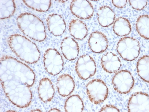 SATB2 Antibody (SATB2/7111) - Azide and BSA Free