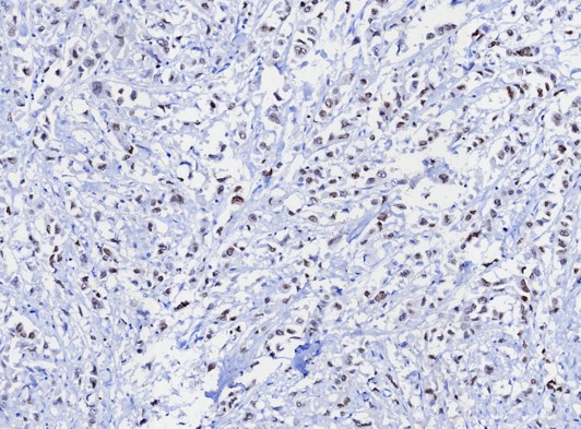 TRPS1 Antibody (TRPS1/8131R) - Azide and BSA Free