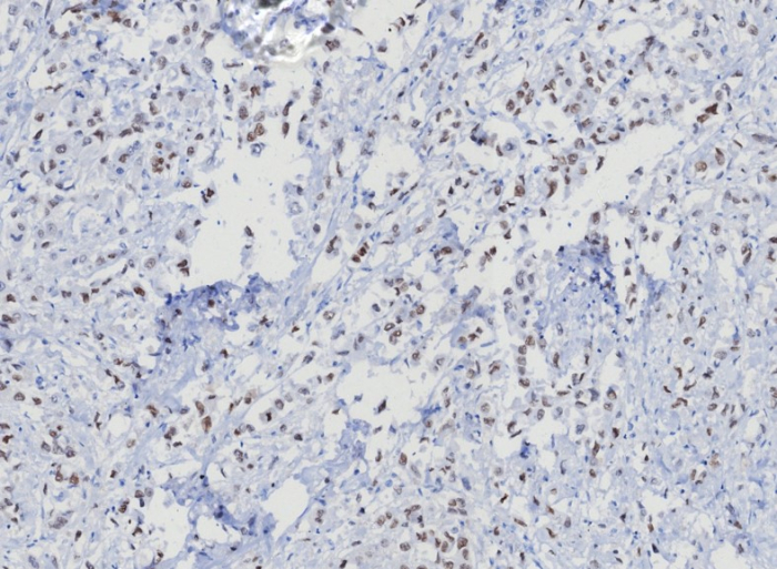 TRPS1 Antibody (TRPS1/8008R) - Azide and BSA Free