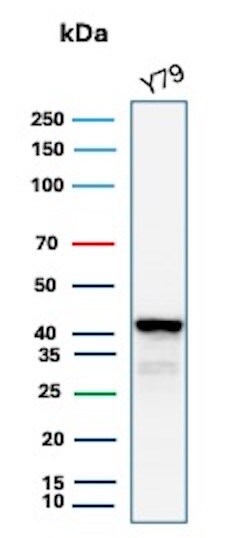 Glutamine Synthetase Antibody (GLUL/8517R) - Azide and BSA Free Western Blot: Glutamine Synthetase Antibody (GLUL/8517R) - Azide and BSA Free [NBP3-21059] -