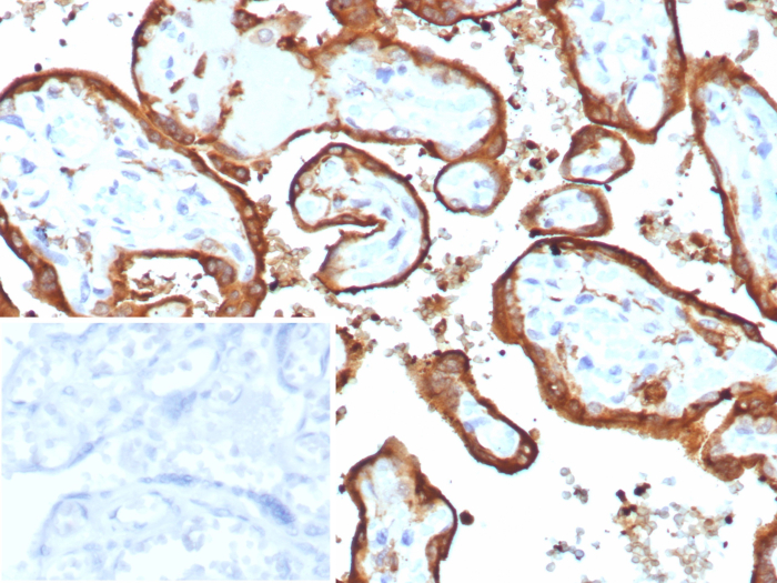 Chorionic Gonadotropin beta Chain (hCG beta) Antibody (HCGa/7806R) - Azide and BSA Free