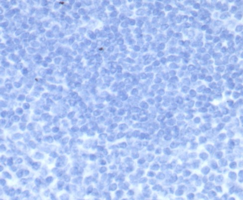 Chorionic Gonadotropin beta Chain (hCG beta) Antibody (HCGb/7512R) - Azide and BSA Free