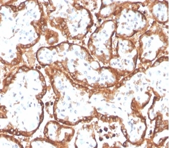 Chorionic Gonadotropin beta Chain (hCG beta) Antibody (HCGb/4709R) - Azide and BSA Free