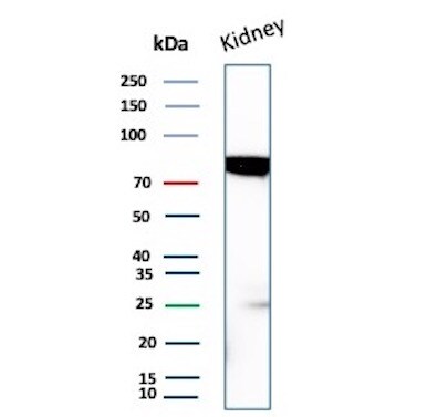 MDM2/HDM2 Antibody (MDM2/7942) - Azide and BSA Free Western Blot: MDM2/HDM2 Antibody (MDM2/7942) - Azide and BSA Free [NBP3-21087] -