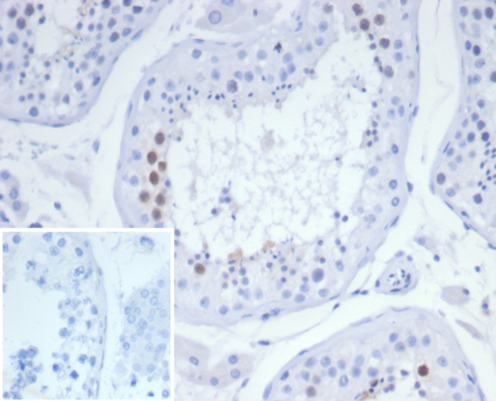 KIF2C Antibody (KIF2C/6525) - Azide and BSA Free