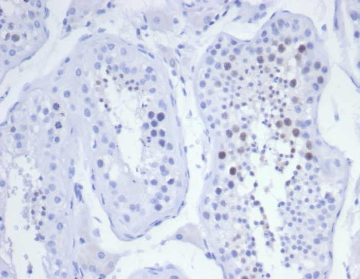 KIF2C Antibody (KIF2C/6525) - Azide and BSA Free