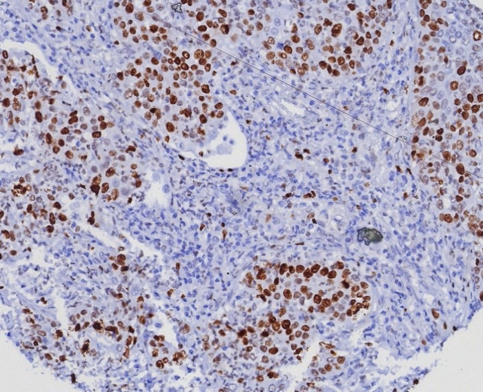 Ki67/MKI67 Antibody (MKI67/8005R) - Azide and BSA Free