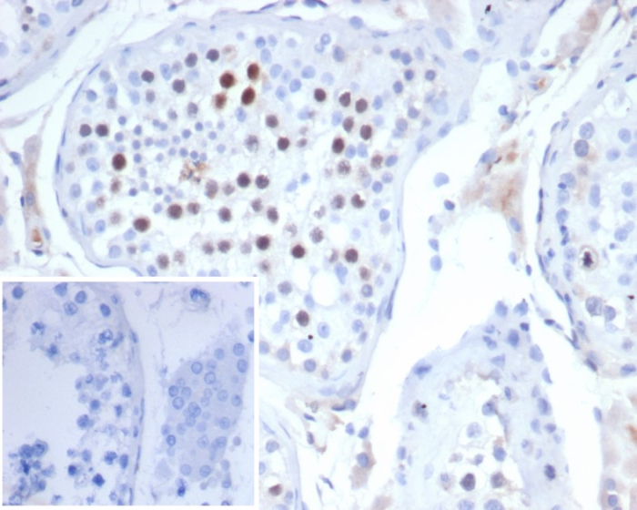 KIF2C Antibody (KIF2C/4702) - Azide and BSA Free