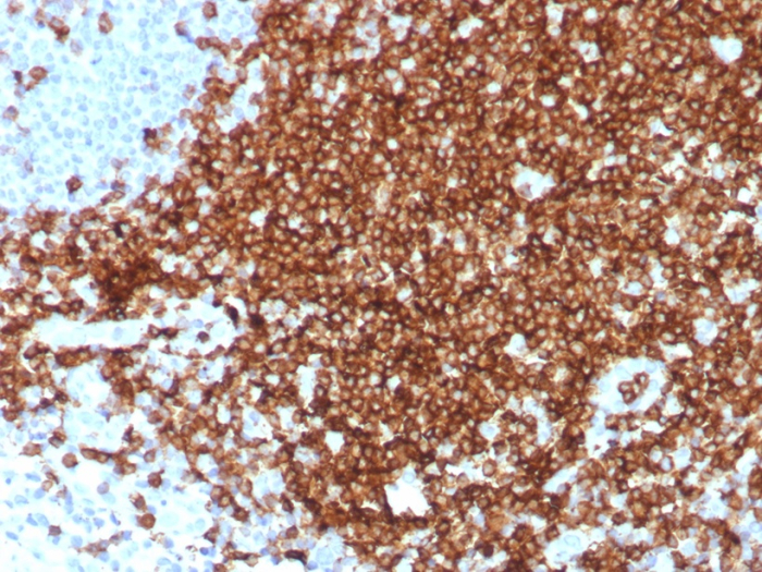 CD7 Antibody (CD7/8496R) - Azide and BSA Free