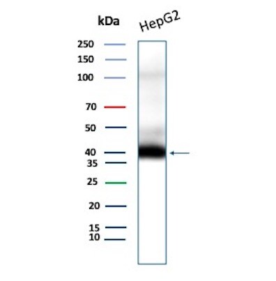CD7 Antibody (CD7/8496R) - Azide and BSA Free Western Blot: CD7 Antibody (CD7/8496R) - Azide and BSA Free [NBP3-21140] -