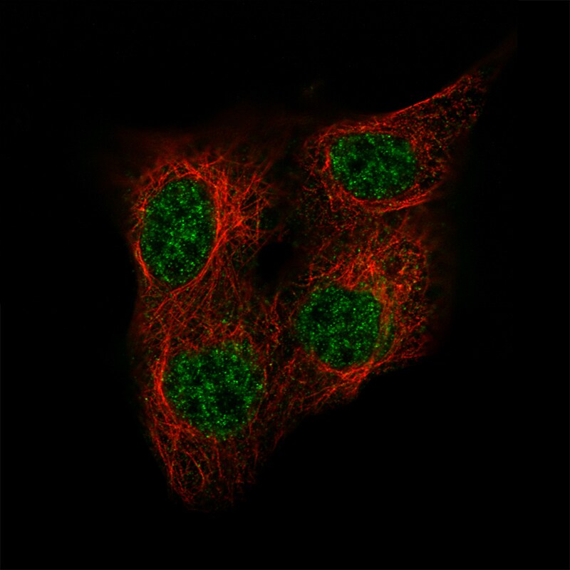 Immunocytochemistry/Immunofluorescence: OCT4 Antibody [NBP3-21158] -