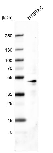 Western Blot: OCT4 Antibody [NBP3-21158] -