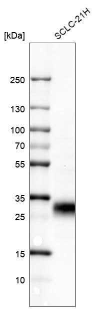 Western Blot: GITR/TNFRSF18 Antibody [NBP3-21159] -