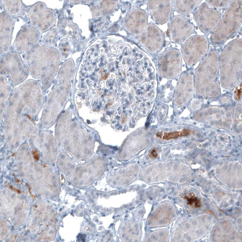 Immunohistochemistry-Paraffin: alpha-Fetoprotein/AFP Antibody [NBP3-21160] -