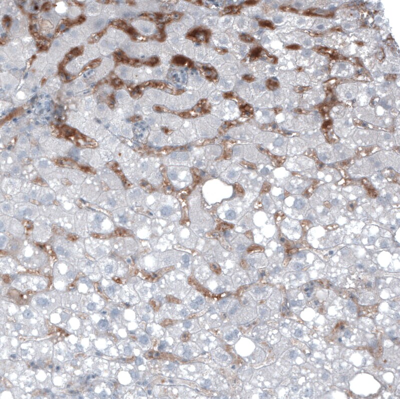 Immunohistochemistry-Paraffin: alpha-Fetoprotein/AFP Antibody [NBP3-21160] -