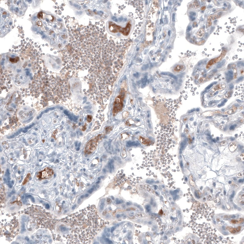 Immunohistochemistry-Paraffin: alpha-Fetoprotein/AFP Antibody [NBP3-21160] -