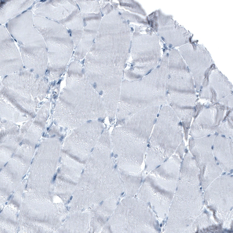 Immunohistochemistry-Paraffin: alpha-Fetoprotein/AFP Antibody [NBP3-21160] -