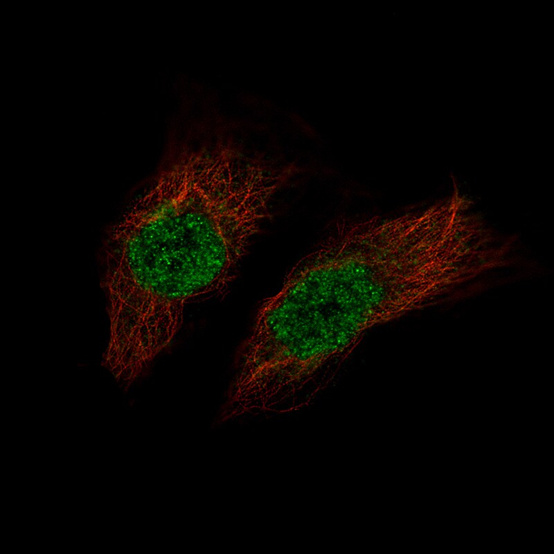 Immunocytochemistry/Immunofluorescence: PAX8 Antibody [NBP3-21161] -