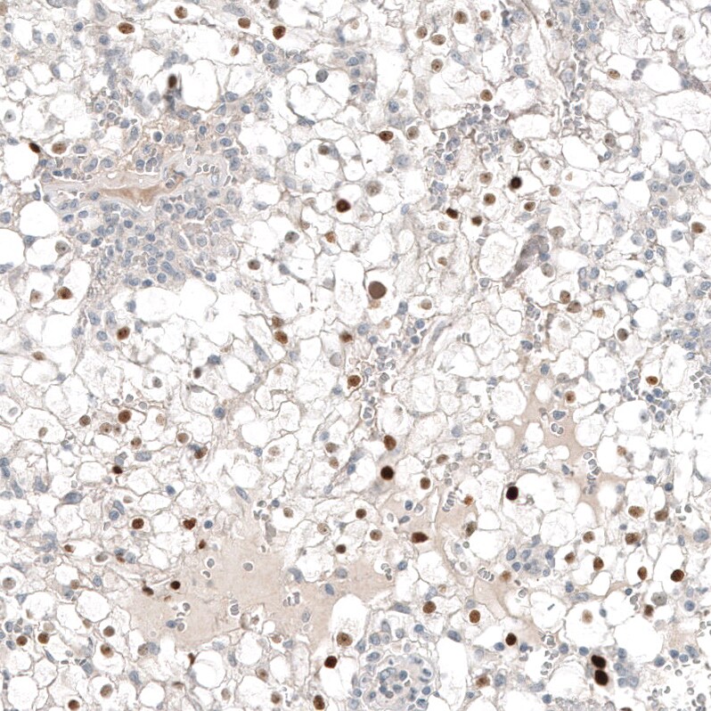 Immunohistochemistry-Paraffin: PAX8 Antibody [NBP3-21161] -