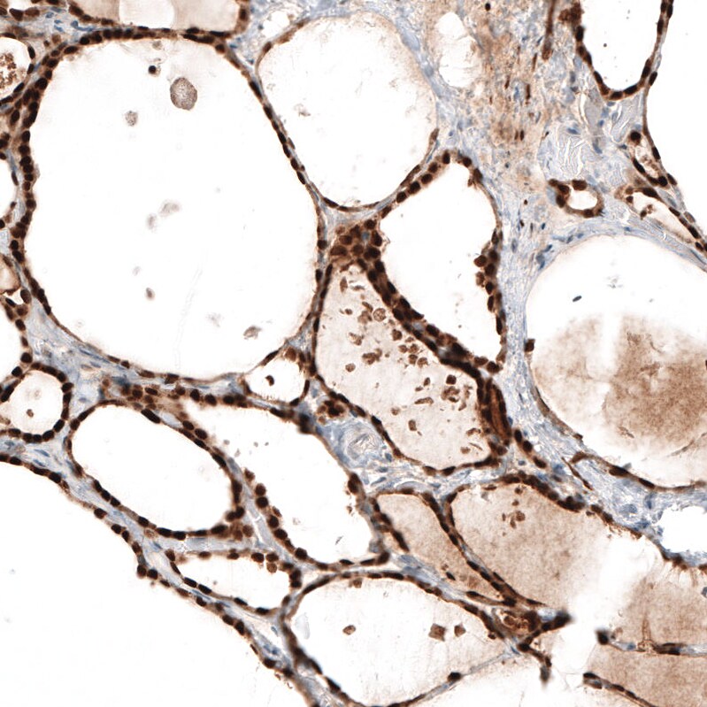 Immunohistochemistry-Paraffin: PAX8 Antibody [NBP3-21161] -