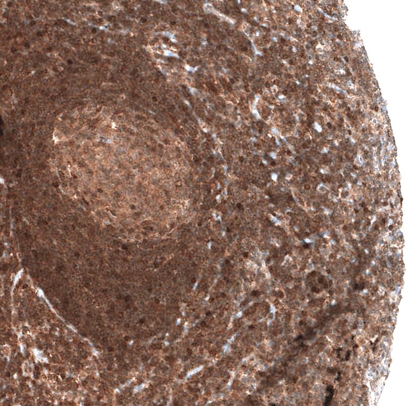 Immunohistochemistry-Paraffin: Bax Antibody [NBP3-21162] -