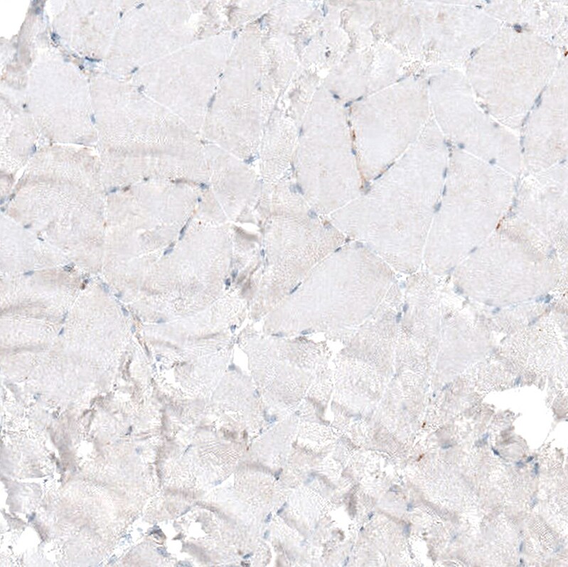 Immunohistochemistry-Paraffin: Bax Antibody [NBP3-21162] -