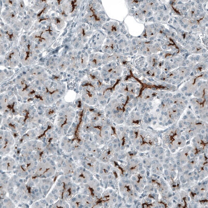 Immunohistochemistry-Paraffin: CD133 Antibody [NBP3-21163] -